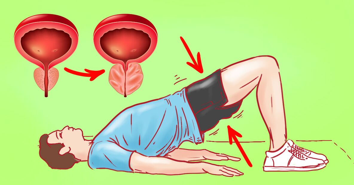 gymnastische oefeningen voor prostatitis